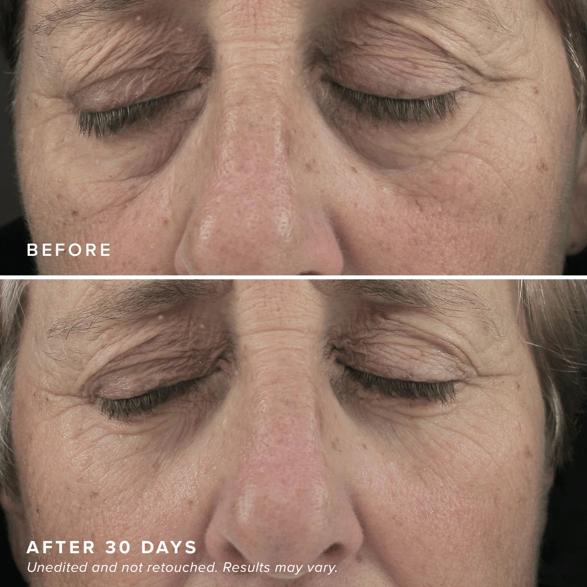 LUXEAL® - Eye Revive Mask