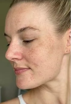 Facial Cleanser LUXEAL®