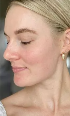Facial Cleanser LUXEAL®